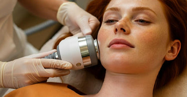 RF Skin Tightening Treatment in Progress