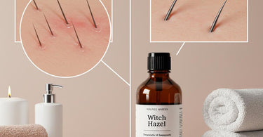 Witch hazel bottle and cotton pads for ingrown hair treatment