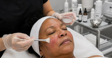 Aesthetician performing a calming facial on a client with rosacea to soothe redness and inflammation.