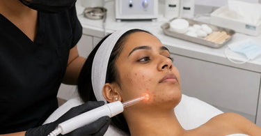 High-frequency spot treatment protocols to treat maskne, featuring a professional esthetician using a high-frequency machine on a client to fight acne-causing bacteria.