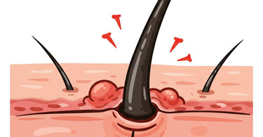 Ingrown Serum for Smooth, Bump-Free Skin