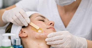 A collage of waxing products and skincare items for acne-prone skin, featuring wax warmers, spatulas, and post-wax soothing lotions.