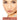 The Complete Guide to Dermal Filler Injections DVD