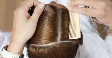 Hair Loss in Women: Time to Embrace and Solve This Devastating Issue