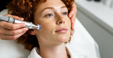 A professional microdermabrasion machine in use during a facial treatment.