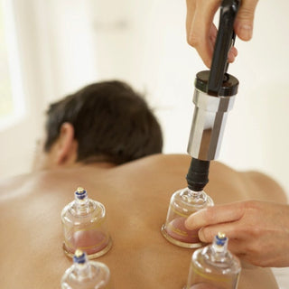 Cupping Therapy