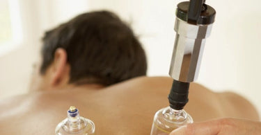 Cupping Therapy