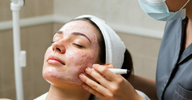 Main Cause of Comedones Blog - Pure Spa Direct