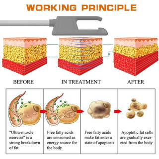 EM Sculpting Machine for Muscle Building and Fat Loss