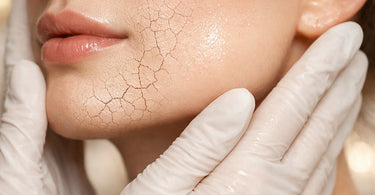 Close-up of a woman's face being gently treated with a creamy ceramide-rich serum by a professional esthetician in a spa setting