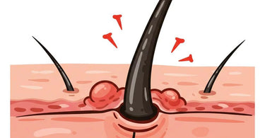 Ingrown Serum for Smooth, Bump-Free Skin