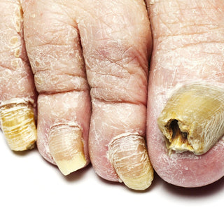 "Cuticle Soup" - Gross Nail Salon Stories... What Your Clients Notice May Surprise You!