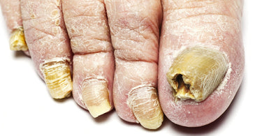 "Cuticle Soup" - Gross Nail Salon Stories... What Your Clients Notice May Surprise You!