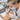 Proper Extraction Techniques For The Delicate Alar Fold Of The Nose - Professional Esthetician Guide and Tools