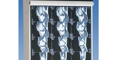 The Trimline Illuminator Standard 14x17 by Wolf X-Ray