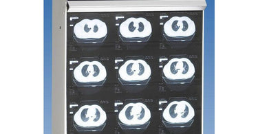 Wolf X-Ray Trimline Plus Hi-Lo standard 14 x 17 six-bulb X-ray illuminator for professional film viewing