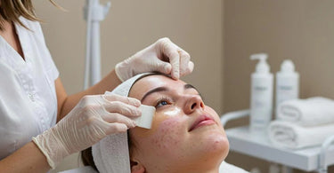 Professional waxing for acne-prone skin with breakout prevention tips