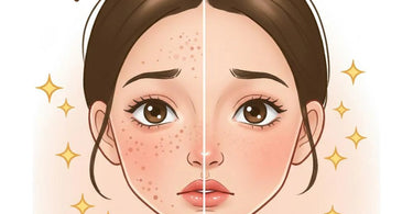 Close-up of skin before and after microdermabrasion showing pore visibility