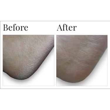 Dr. Canuso Daily Exfoliating Cleanser - Exfoliate, Cleanse and Deodorize Feet / 1 Case = 8 Units X 4 oz. - 116 mL. Each by Dr. Canuso