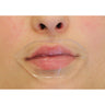 Lip Collagen Mask / Pack of 60 Masks - Each is Single Use by Martinni