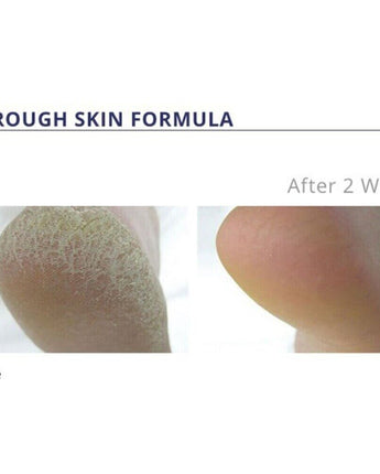 Rough Skin Formula #7+ / 4.2 oz. by Footlogix