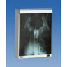 The Econoline Illuminator / Standard 14"x17" by Wolf X-Ray