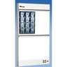 Trimline III Illuminator / 2 over 2 (3 Bulb) by Wolf X-Ray