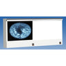 VuPlus Mammography Illuminator / Double Unit / 4 Film Viewing by Wolf X-Ray