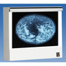 VuPlus Mammography Illuminator / Single Unit / 2 Film Viewing by Wolf X-Ray