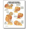Whiplash Injuries of Head & Neck 20" X 26" Styrene